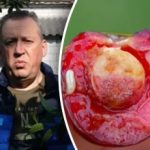 Proč jsou třešně červivé: nečekaný důvod